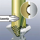 Технология Lasertip